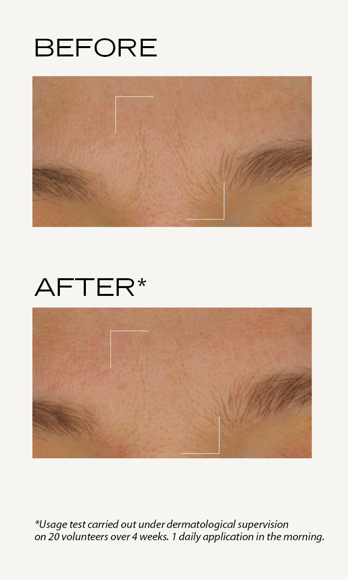 BEFORE-AFTER_Roselift_EN_CC_Crème_2.png