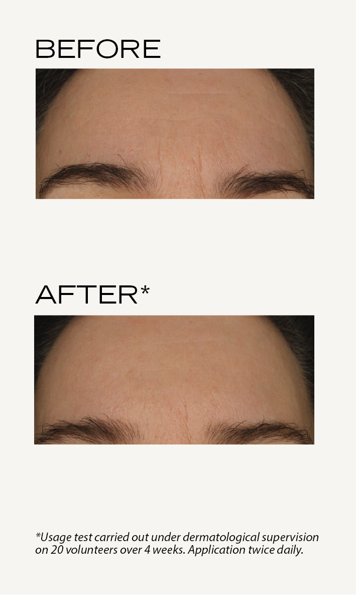 BEFORE-AFTER_My_Payot_EN_Sérum_vitamine_C_3.png
