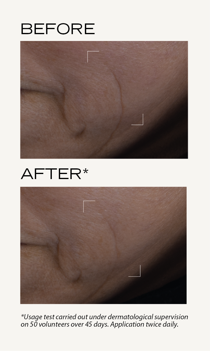 BEFORE-AFTER_Neo-serum_EN_Neo_8.png