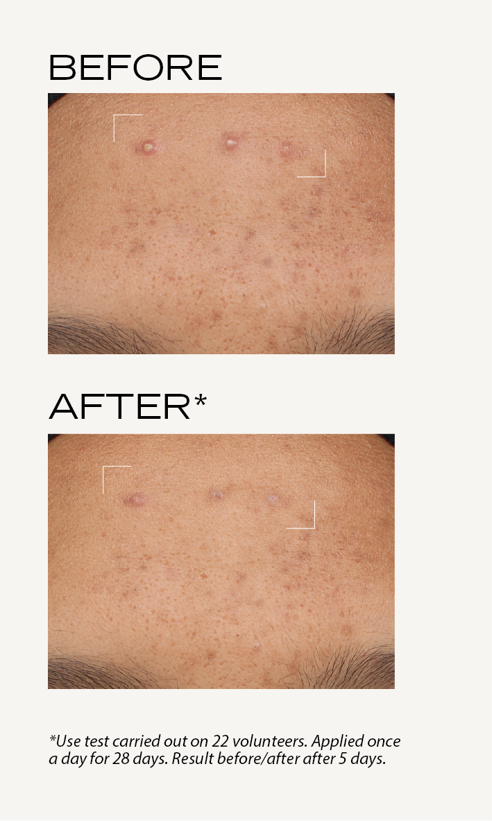 BEFORE-AFTER_Pâte_grise_Spéciale_5_EN.png