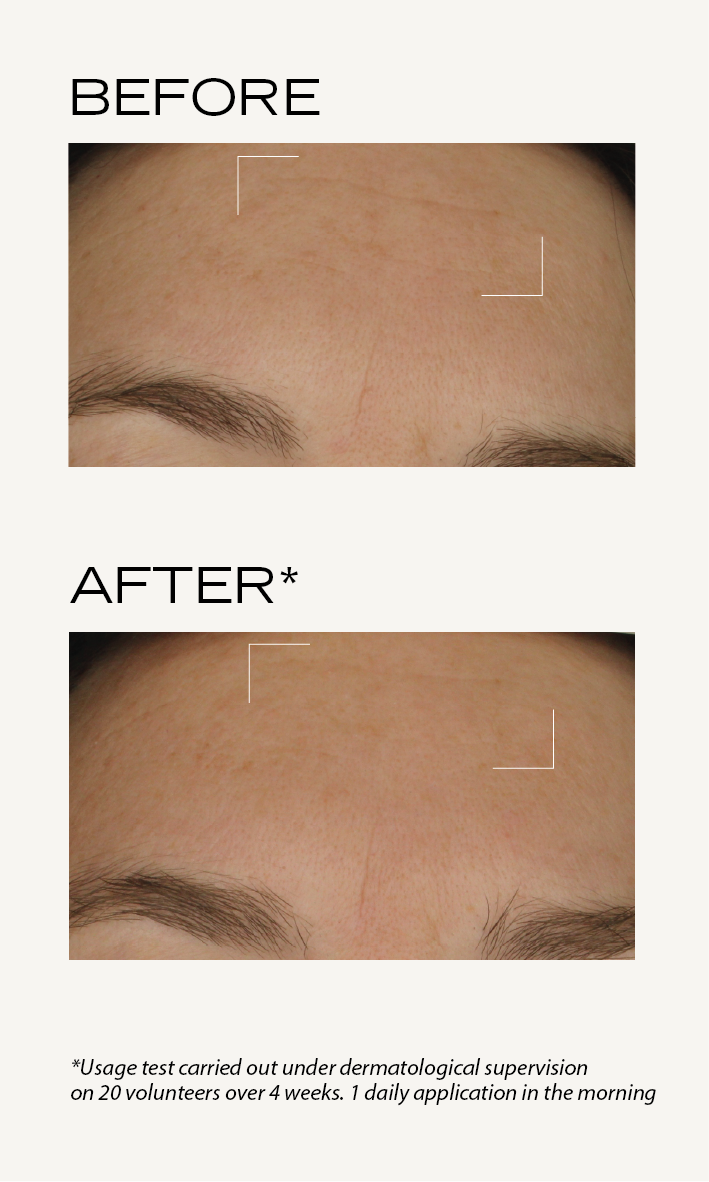 BEFORE-AFTER_Roselift_EN_Crème_rose_3.png