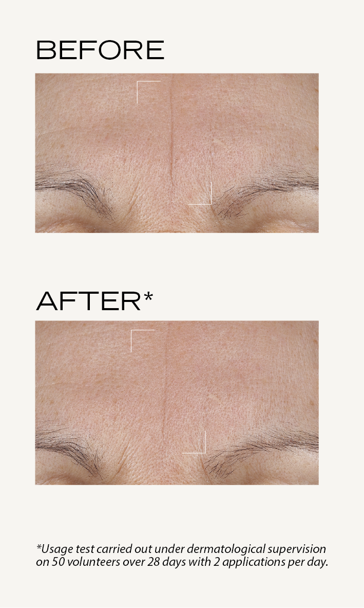 BEFORE-AFTER_Suprême_Absolu_Crème_jeunesse_EN_Crème_jeunesse_3.png