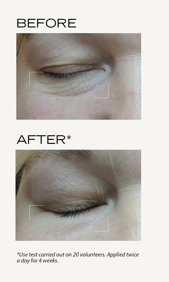 BEFORE-AFTER_Lisse_Soin_défroisant_EN.png