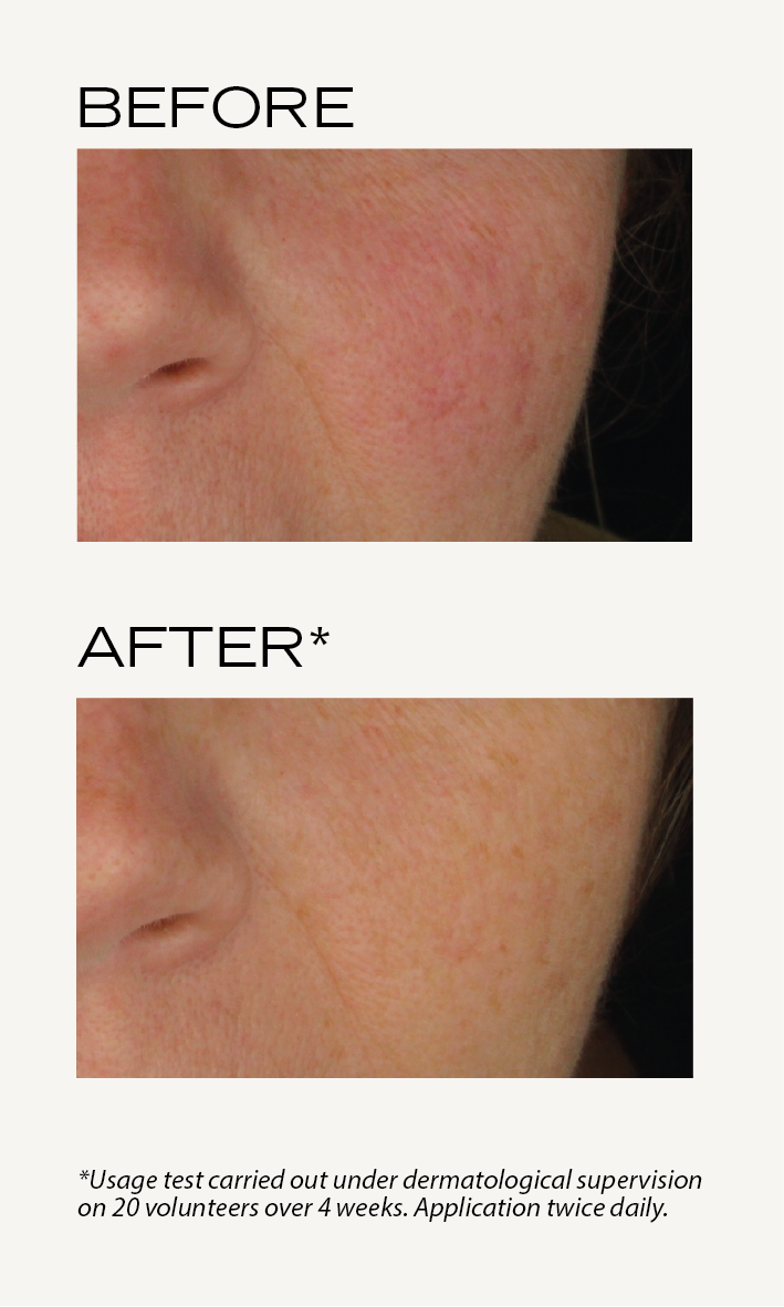 BEFORE-AFTER_My_Payot_EN_Sérum_vitamine_C_1.png