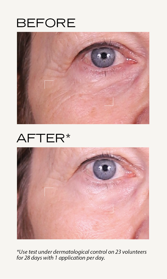 BEFORE-AFTER_Lisse_EN_Sérum_booster_1.png
