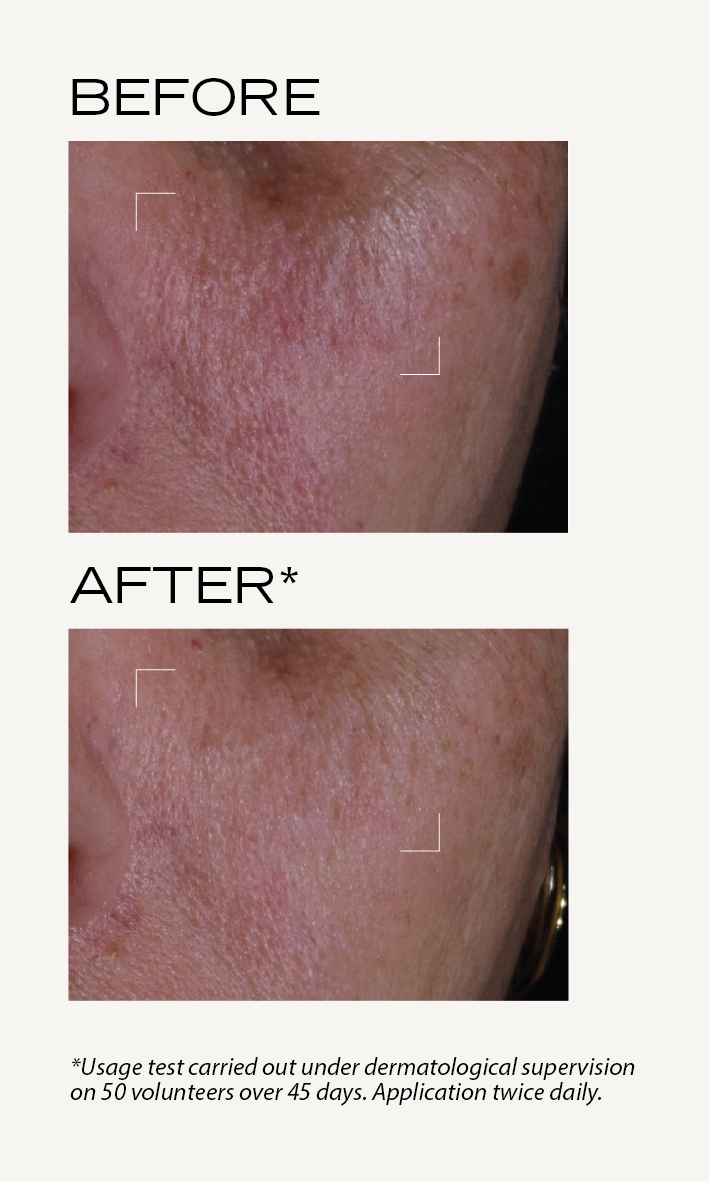 BEFORE-AFTER_Neo-serum_EN_Neo_4-04.png