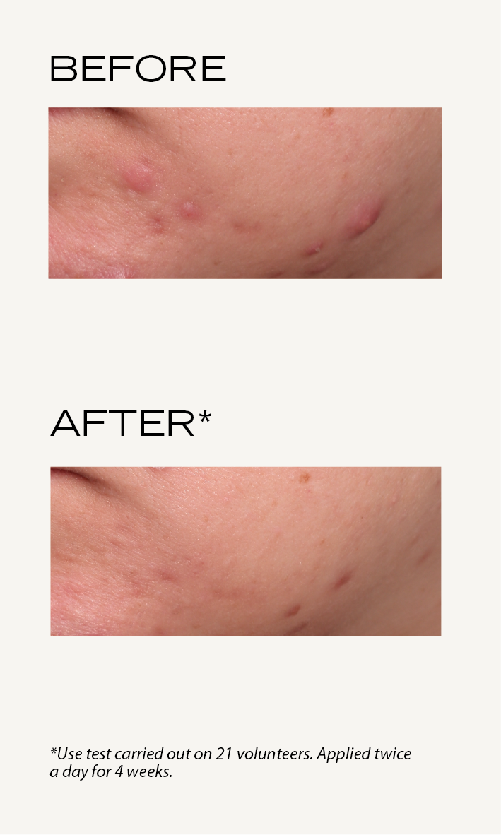 BEFORE-AFTER_Pâte_grise_Emulsion_matifiante_EN_Émulsion_matifiante_1.png