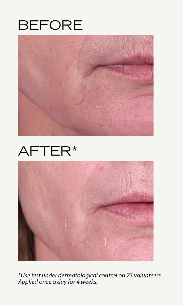 BEFORE-AFTER_Lisse_EN_Crème_lissante_rides_2.png