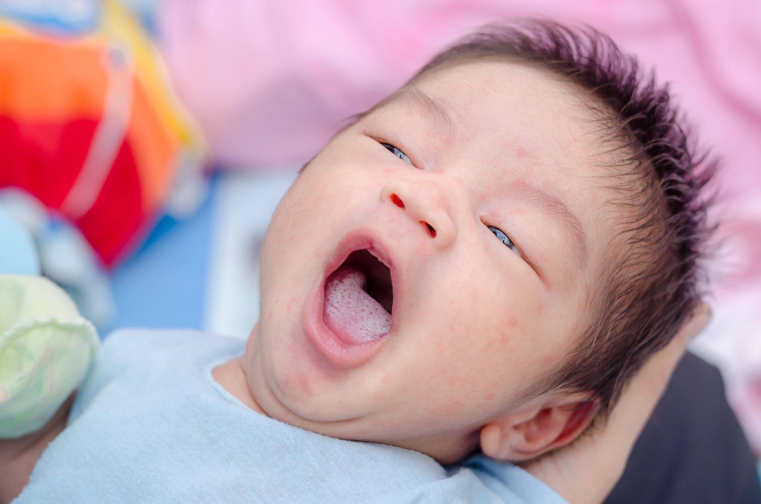 3 home remedies for treating your baby’s oral thrush