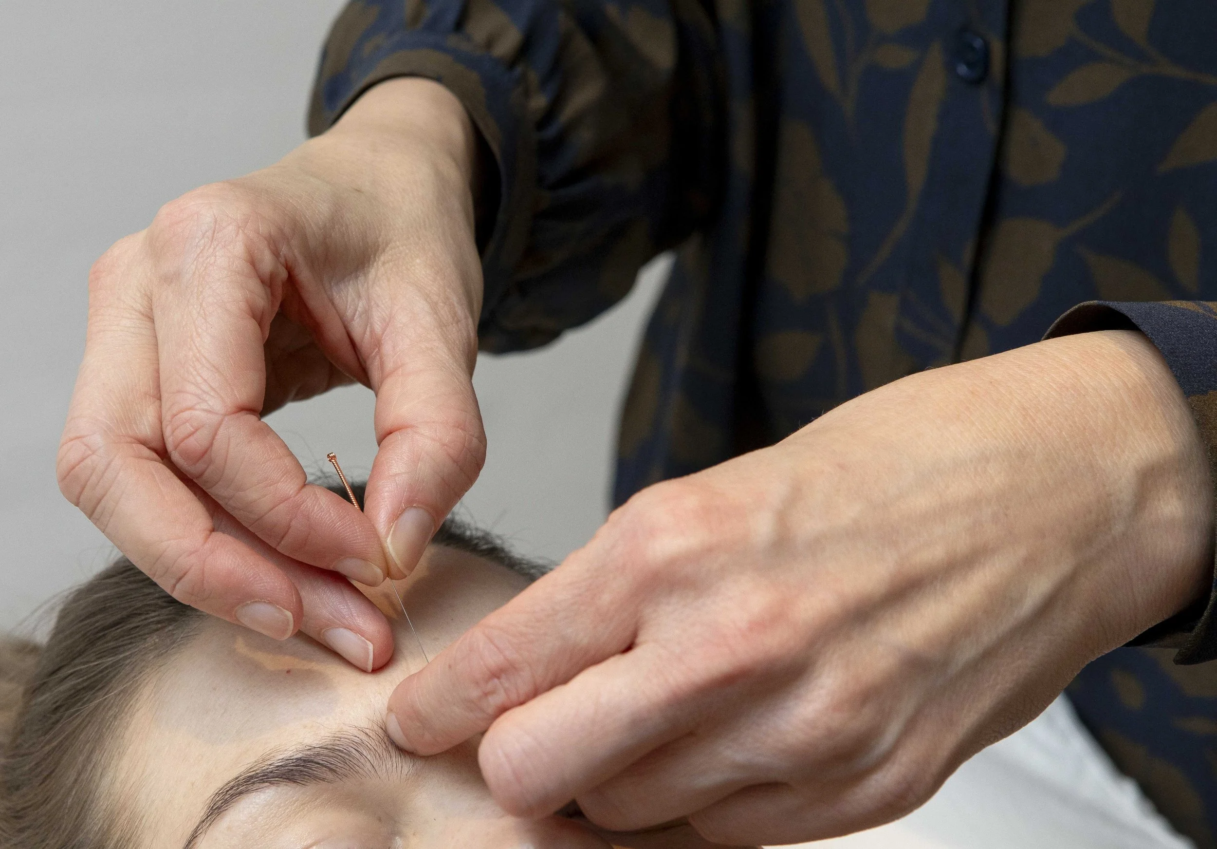 Akupunktur stress Lyby Akupunktur Aalborg