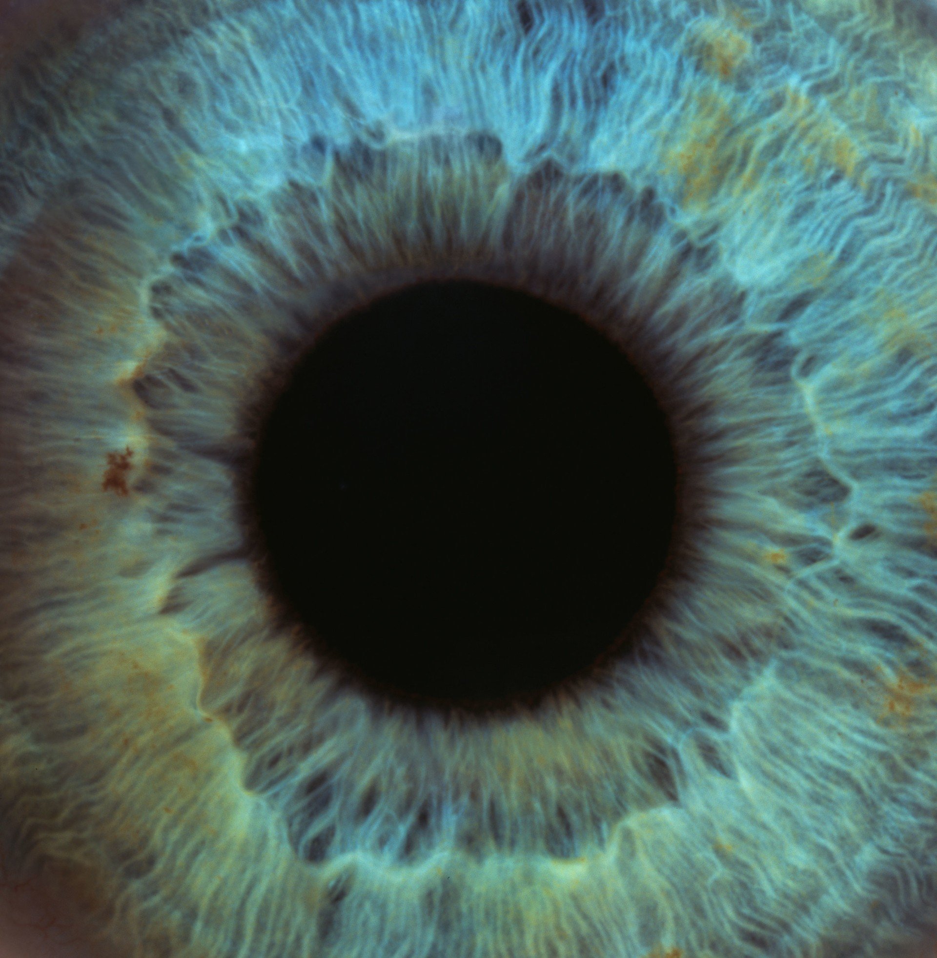 Visual Overstimulation and Cognitive Fatigue: Why the Eyes Need Recovery