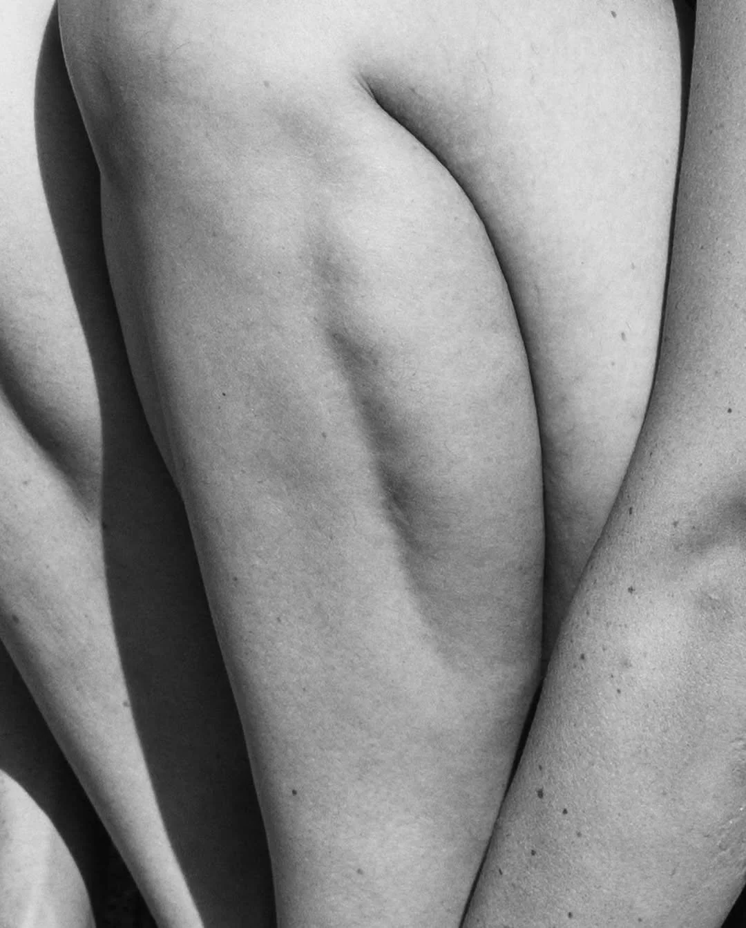 Leg Compression Therapy: Supporting Circulation and Recovery