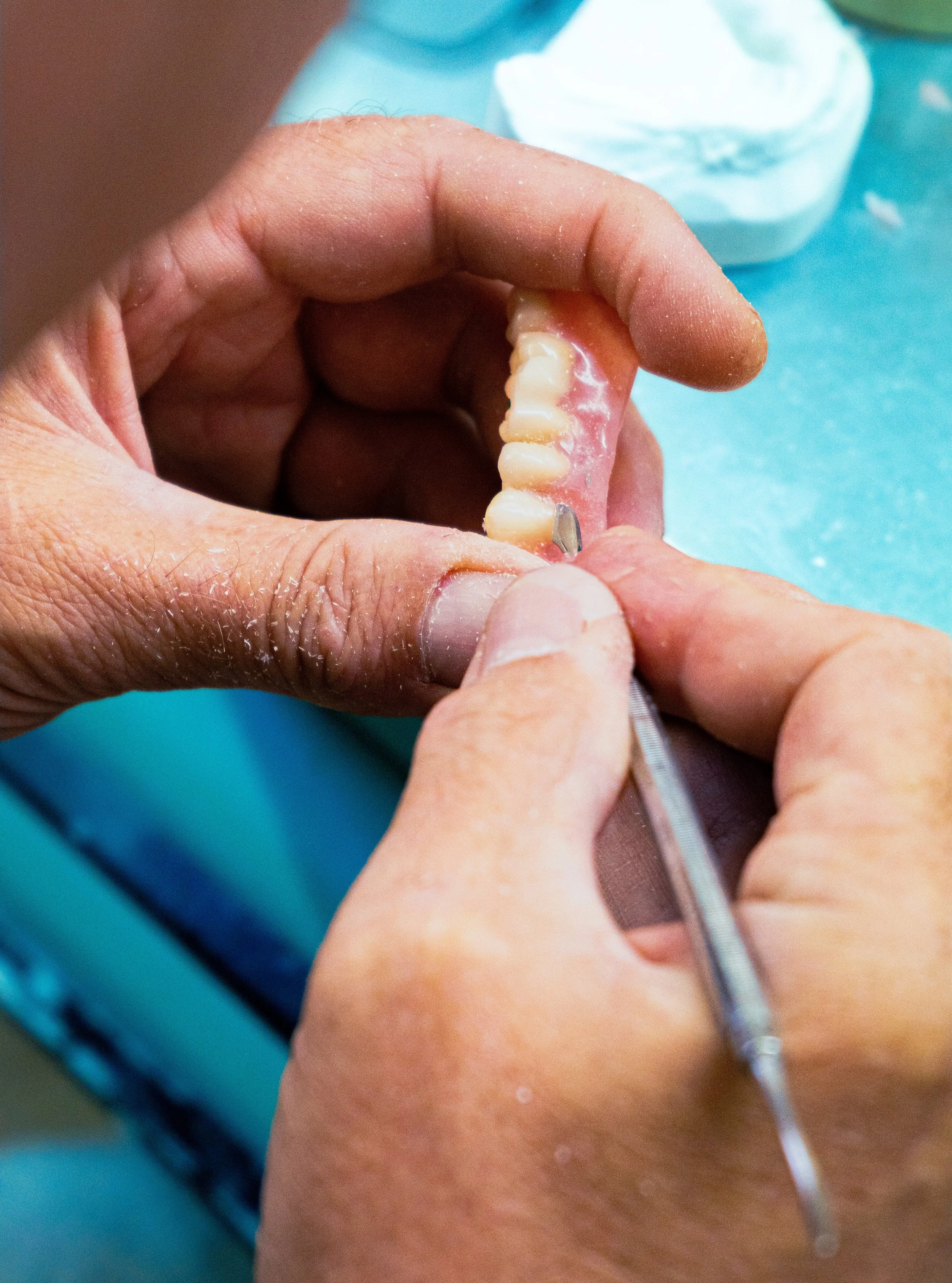 A denture in production at Griffen Dental, where teamwork between the dentist and laboratory is an important part of the process.

Every case starts with understanding the dentist&rsquo;s prescription and the requirements of the individual patient. O