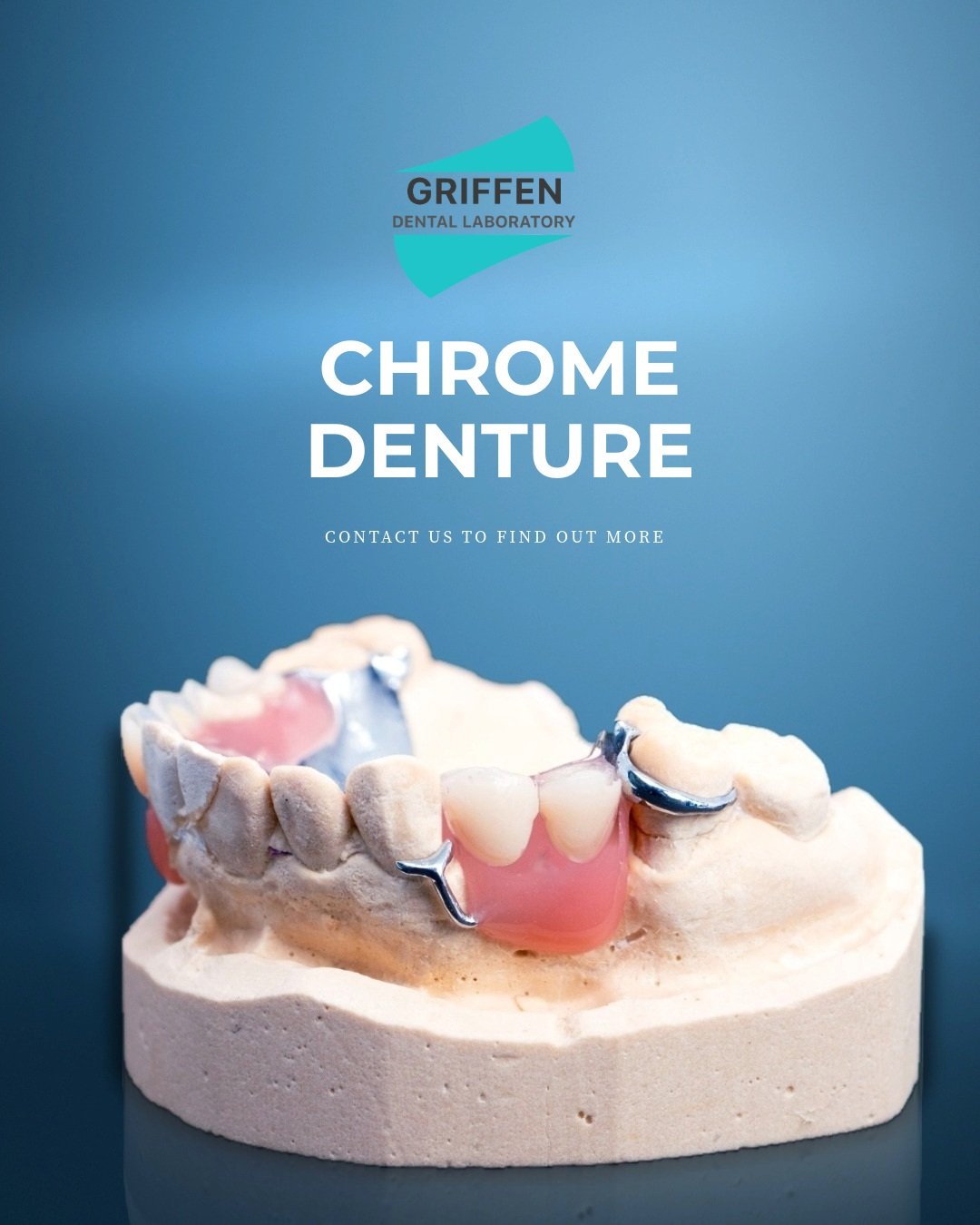 A recent chrome denture completed by the Griffen Dental Laboratory team.

Chrome dentures require careful planning and precision throughout the process, from the initial framework design through to the final finishing stages.

Every case is planned a