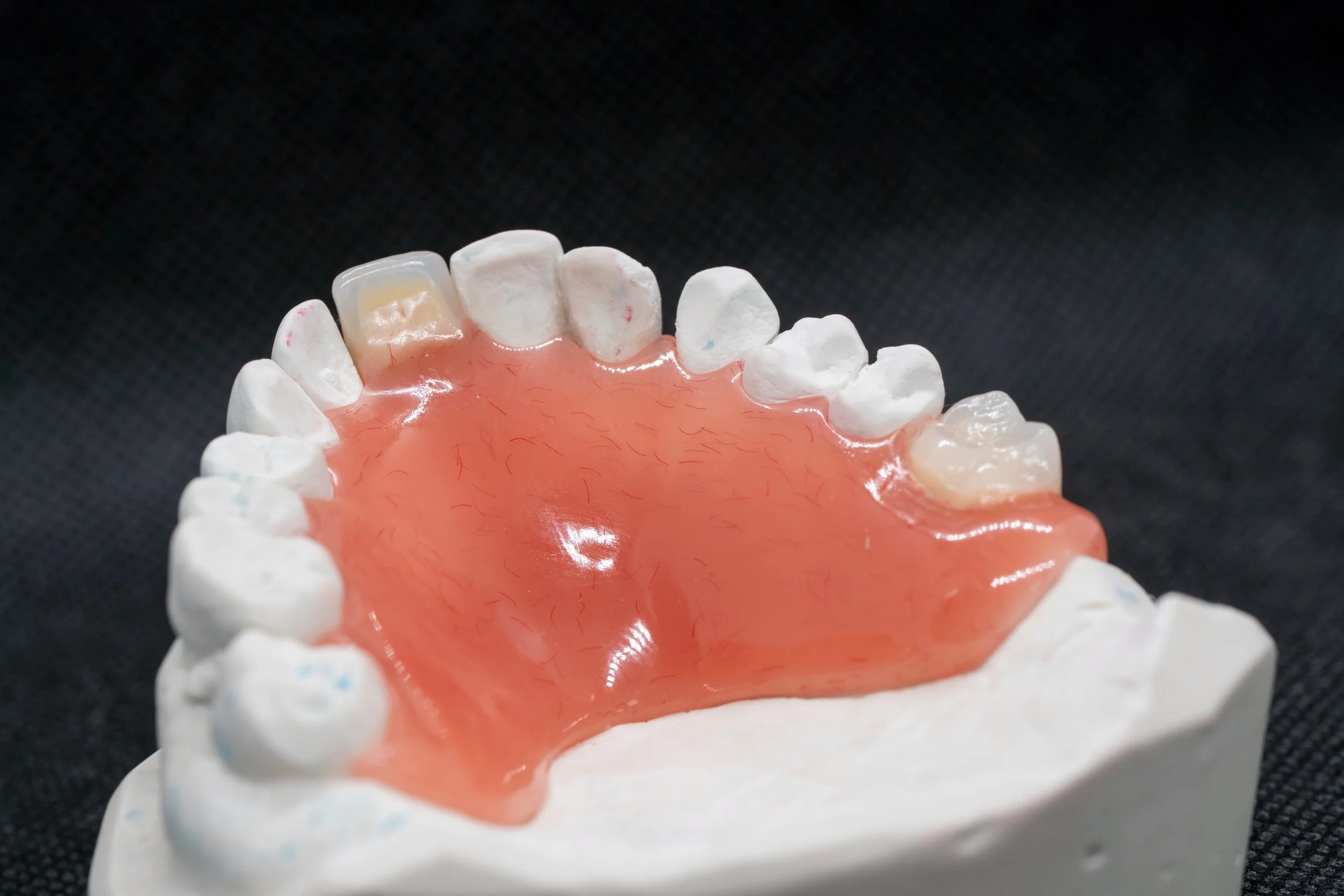 DENTURE CASES ARE ON THE RISE.

The number of registered dental technicians has fallen for six consecutive years, with fewer than 5,000 now registered in the UK. The average age of a denture technician in the UK is approximately 63!

With an ageing a