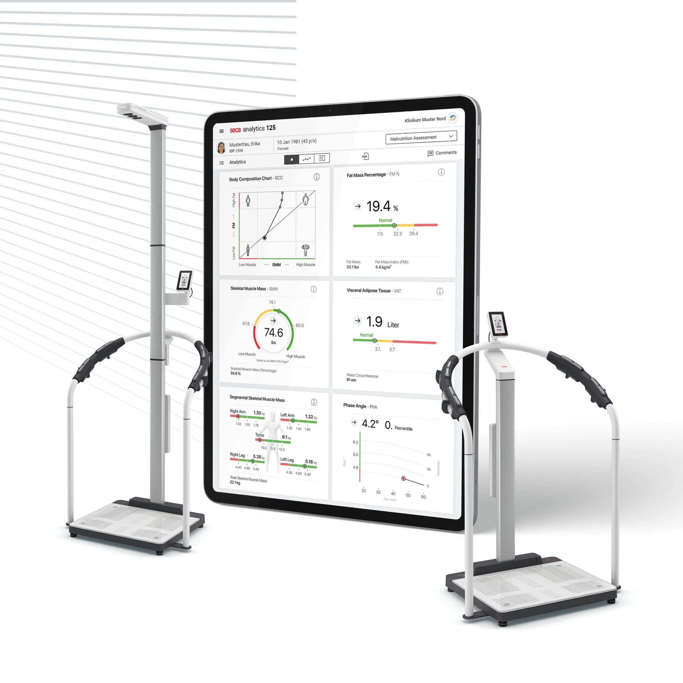 Medical body composition analysis device with two bioelectrical impedance analysis scales connected to a digital screen displaying health data and statistics.