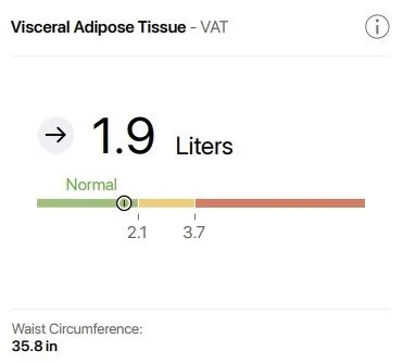 Medical report showing visceral adipose tissue measurement of 1.9 liters, within normal range, with waist circumference of 35.8 inches.