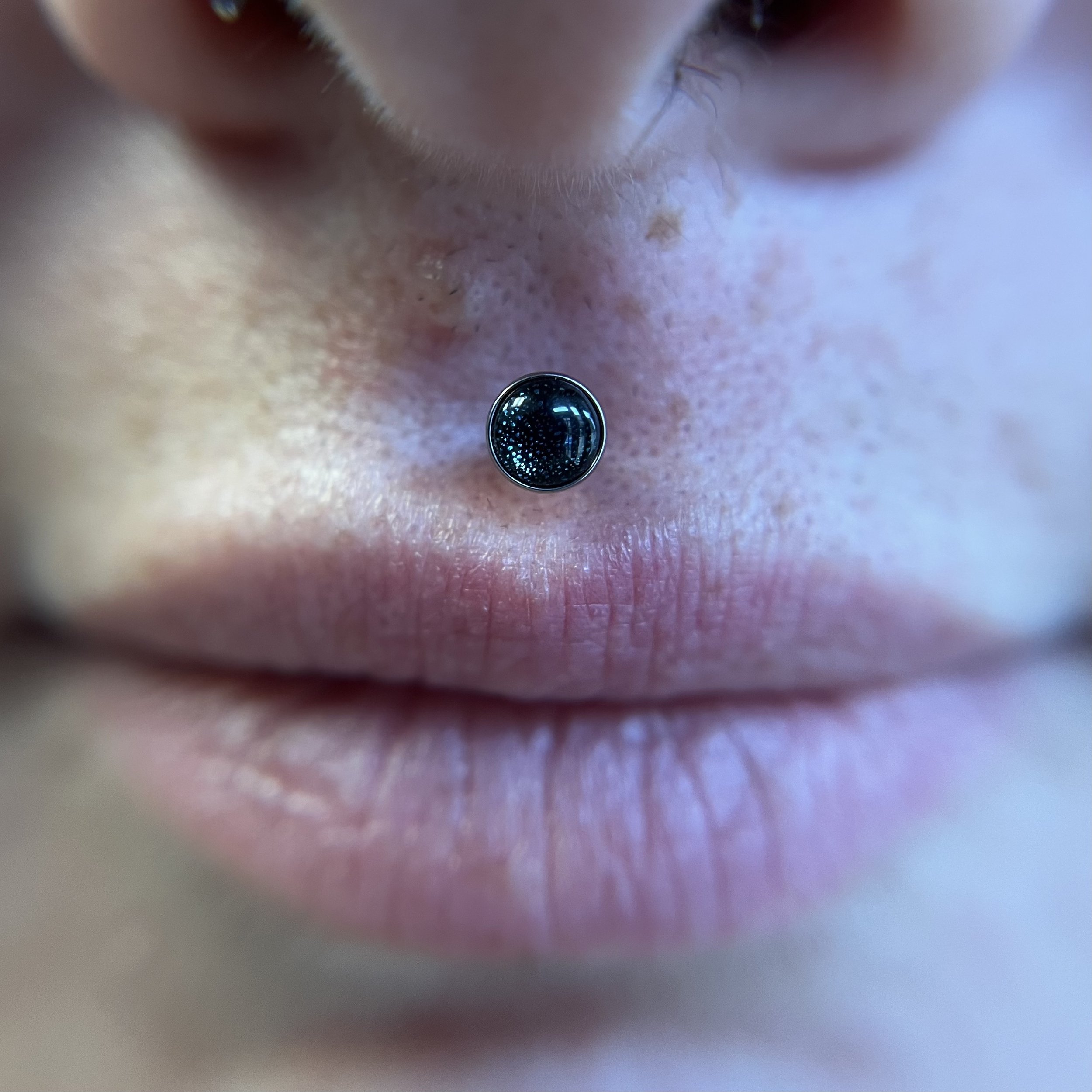 Philtrum_4.jpeg