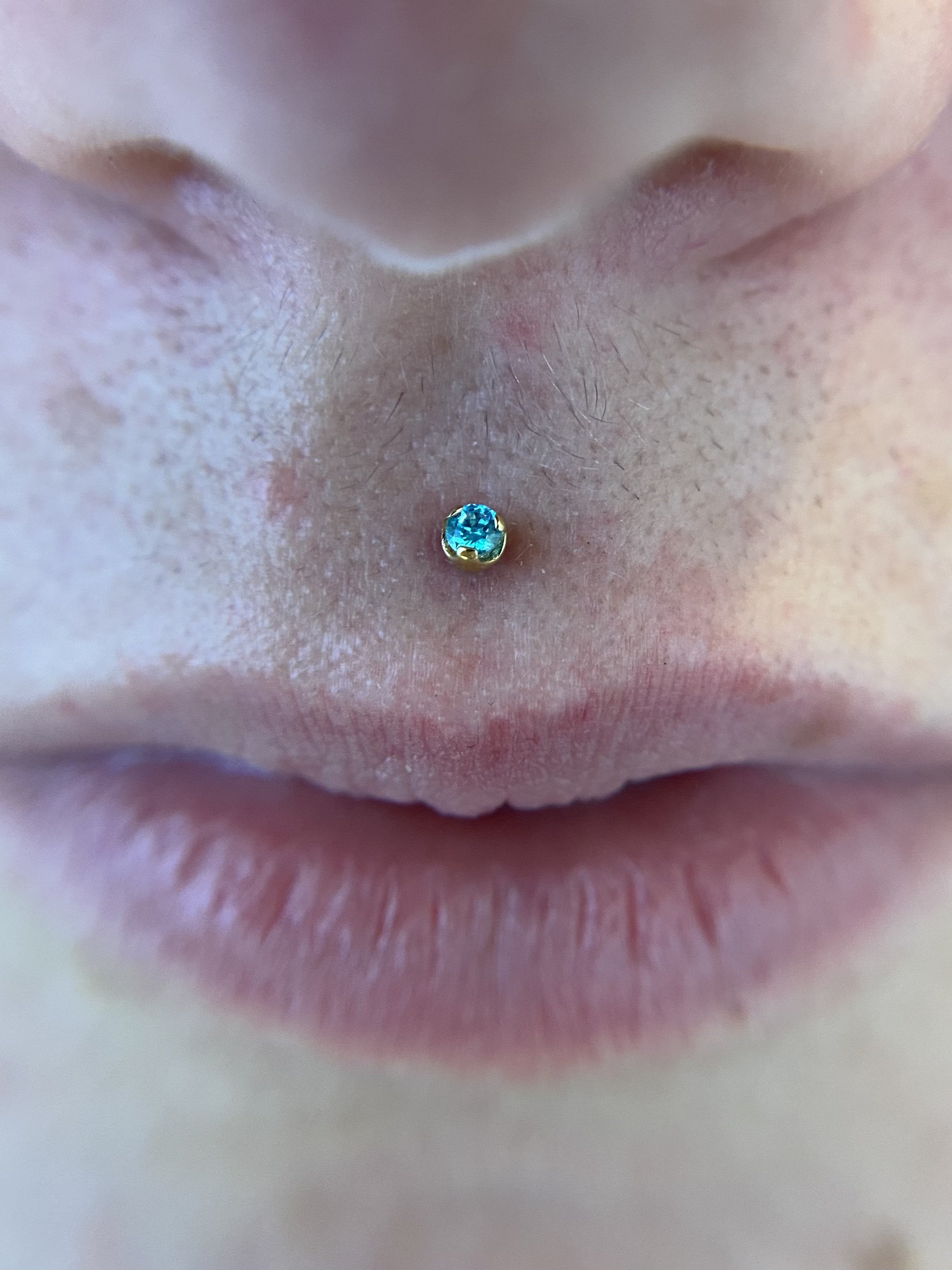 Philtrum_7.jpeg