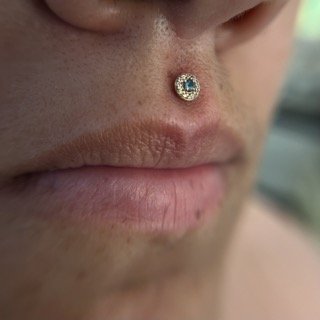Philtrum_9.jpeg