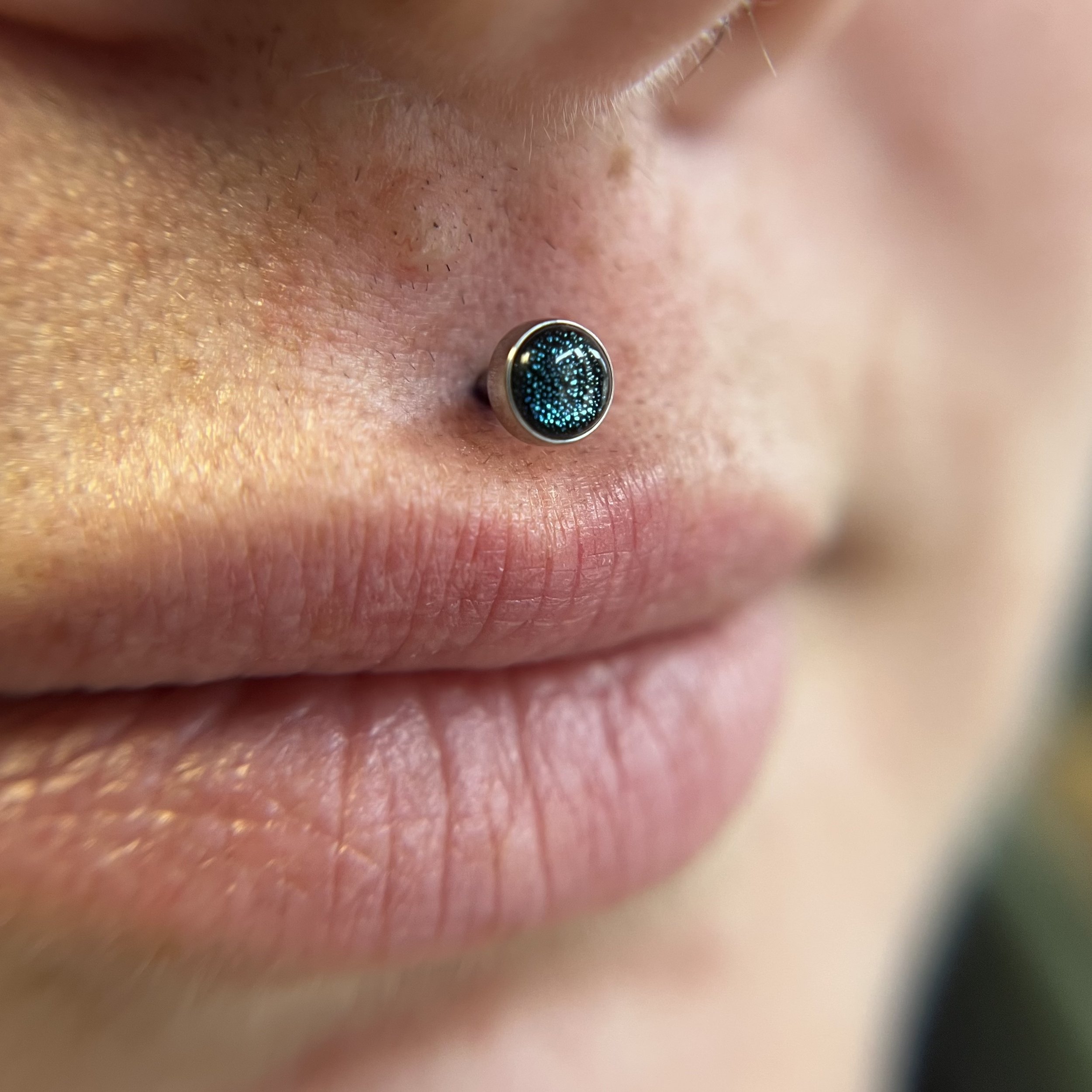 Philtrum_5.jpeg