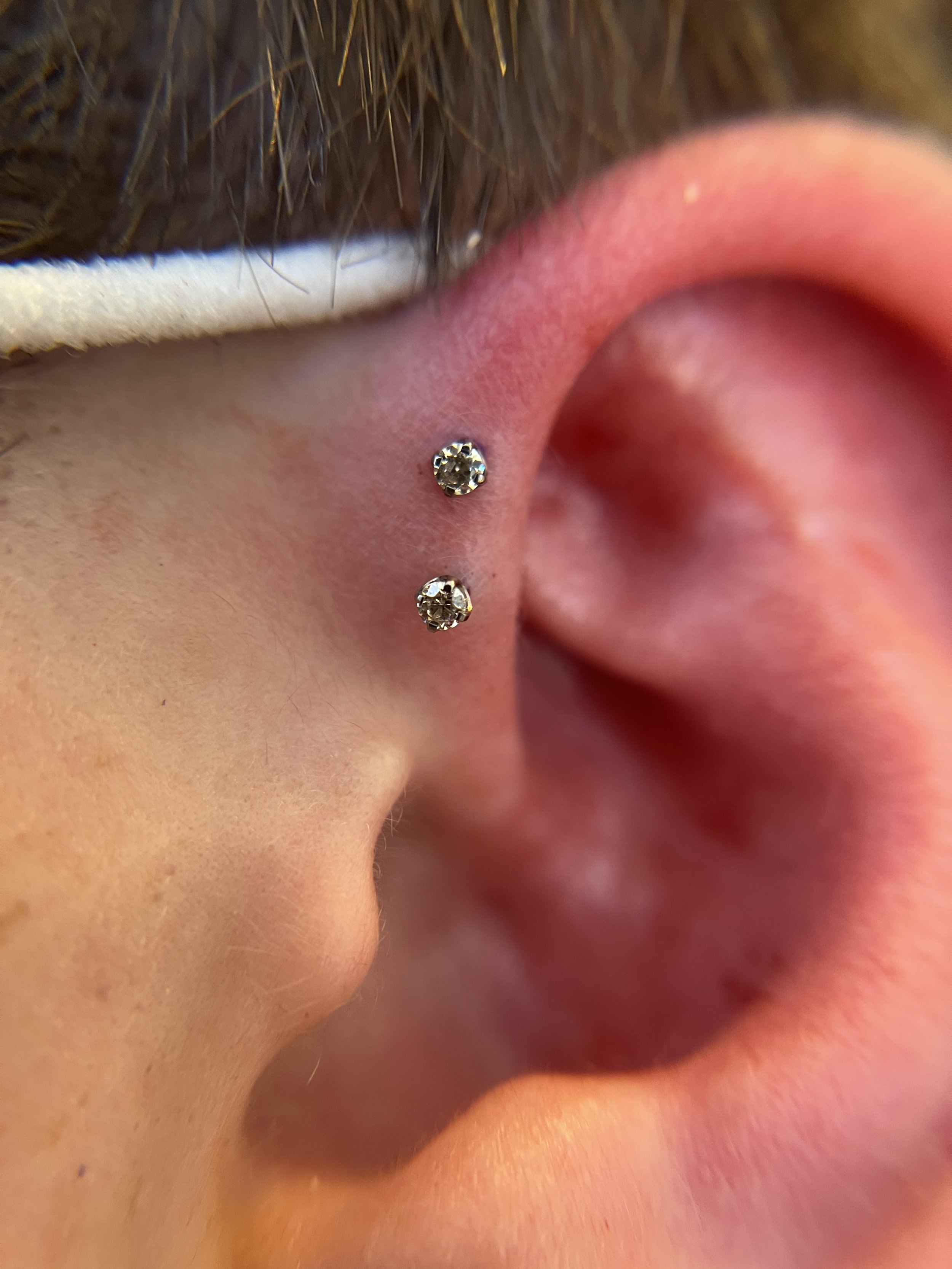 Forward Helix_6.jpeg