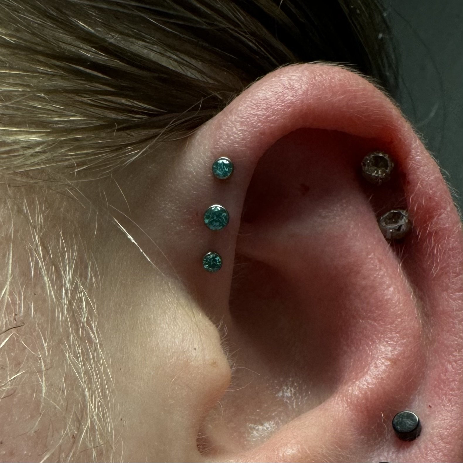 Forward Helix_2.jpeg