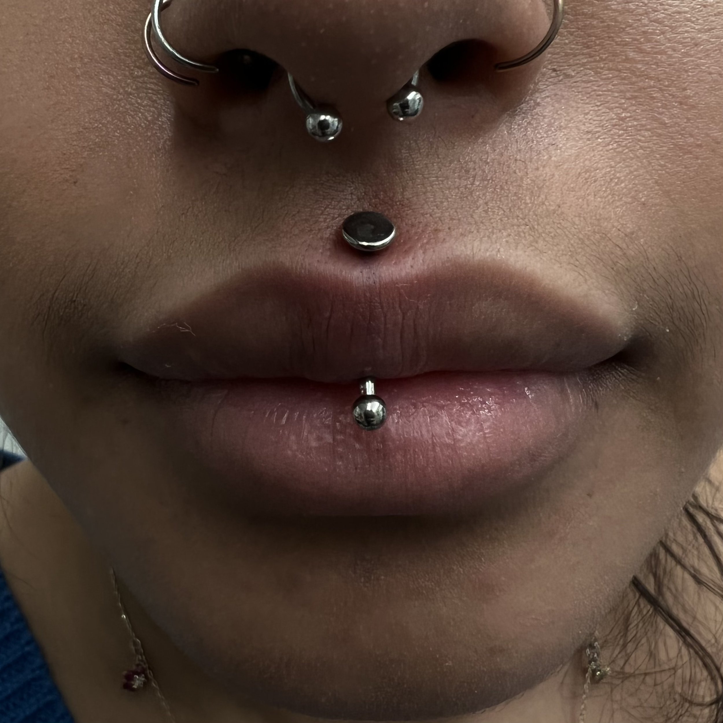Jestrum-Vertical Philtrum_13.jpeg