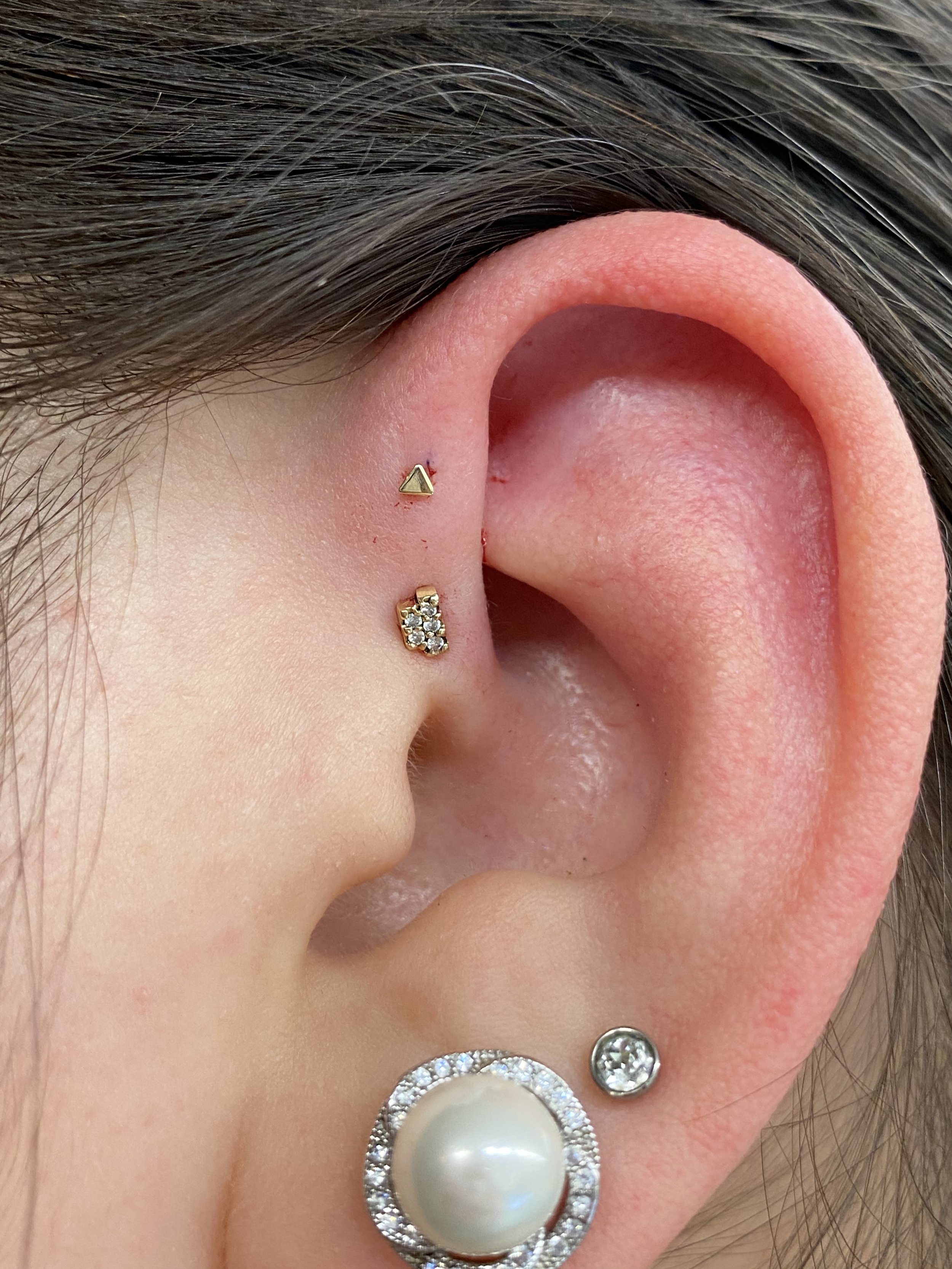 Forward Helix_4.jpeg