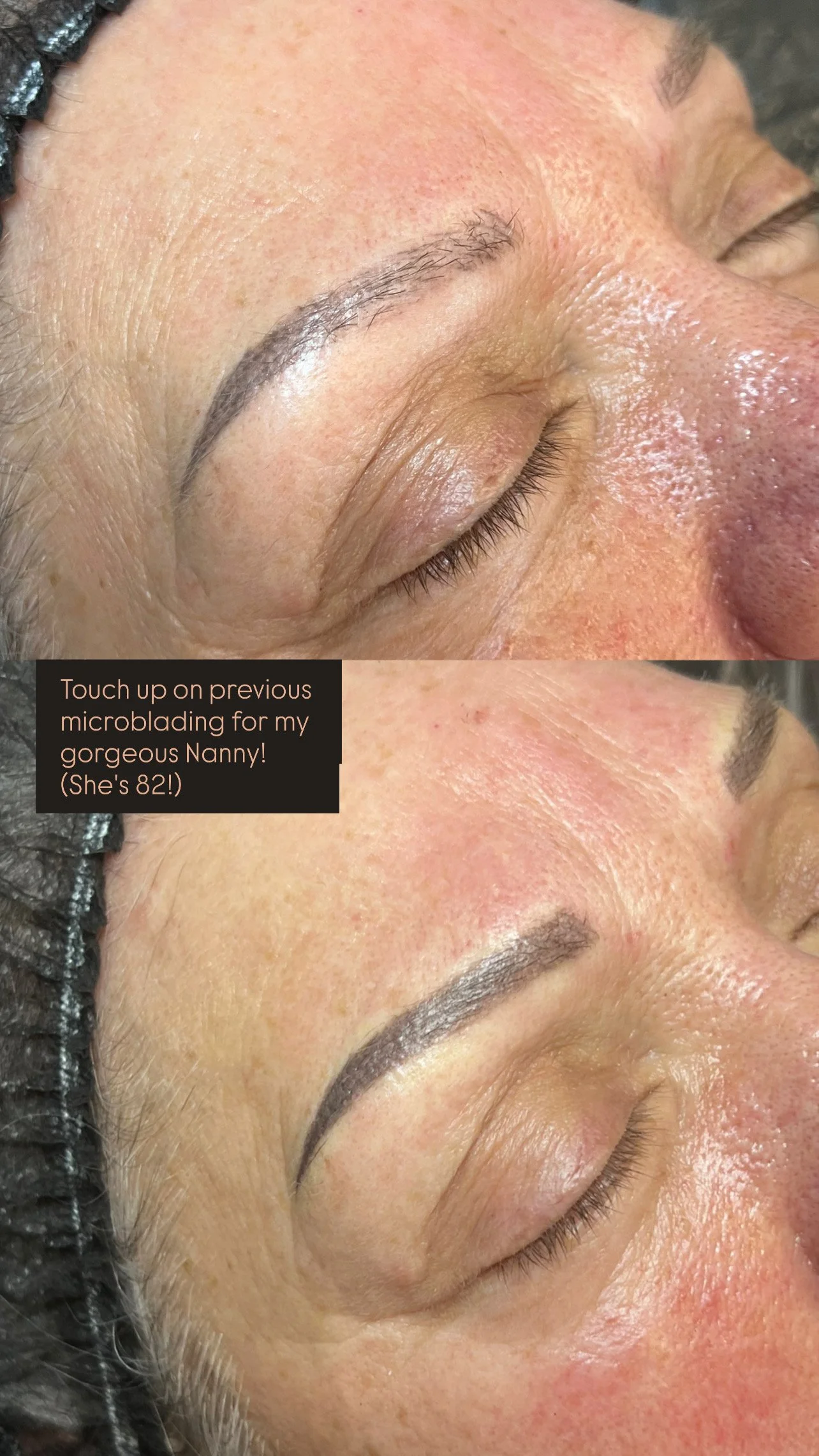 Close-up of a person's face showing the results of microblading on their eyebrows, with the upper section depicting a treated eyebrow and the lower section showing the skin after healing, with a note about the person's 82-year-old nanny.