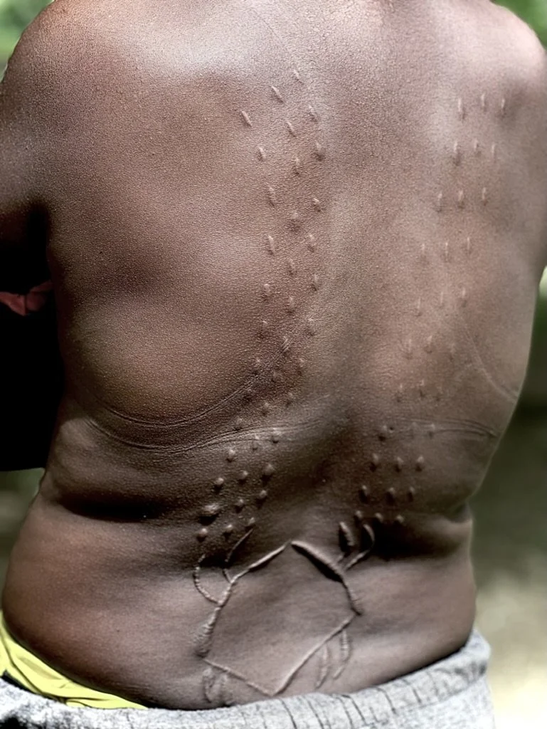Close-up of a Crocodile Man’s back showing ceremonial scarification scars, part of an initiation ritual practiced by tribes along the Sepik River in Papua New Guinea to honor the spirit and strength of the crocodile.