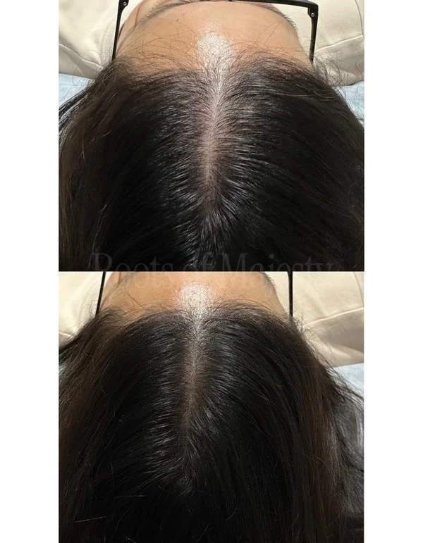 widening middle parting smp singapore for women