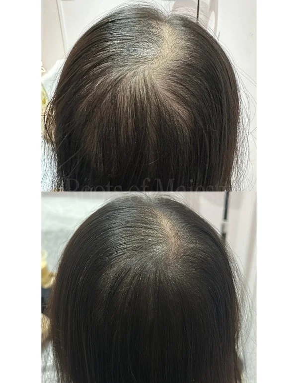 SMP Singapore Before After Transformation Results For Women