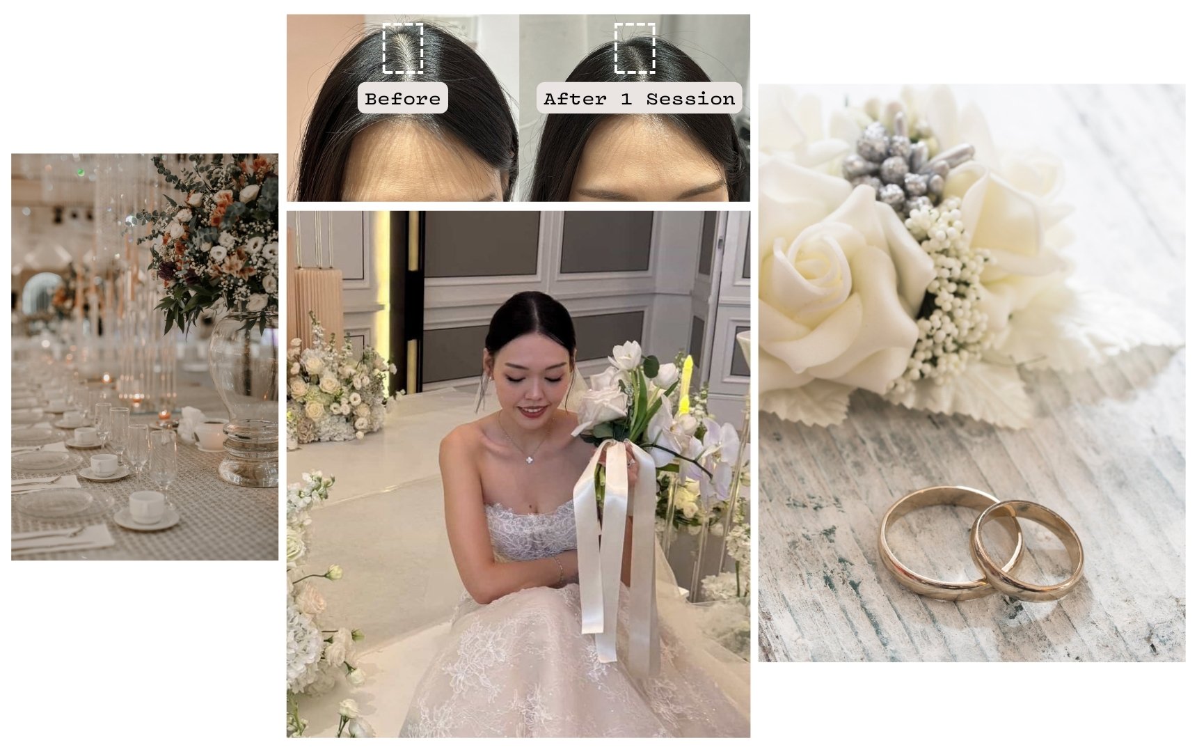 How to Look Your Best on Your Wedding Day: Must-Try Beauty Treatments in Singapore