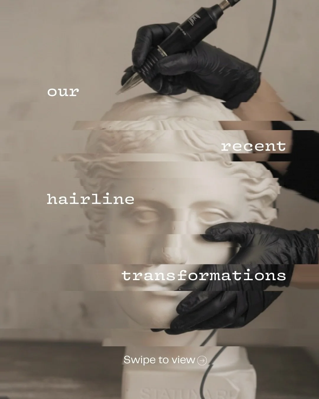 Scalp micropigmentation helps to shape your face&hellip;
by softly refining your parting and creating the illusion of fuller, denser hair where it matters most.

It&rsquo;s a non-surgical solution, zero downtime, and most customers say it is painless