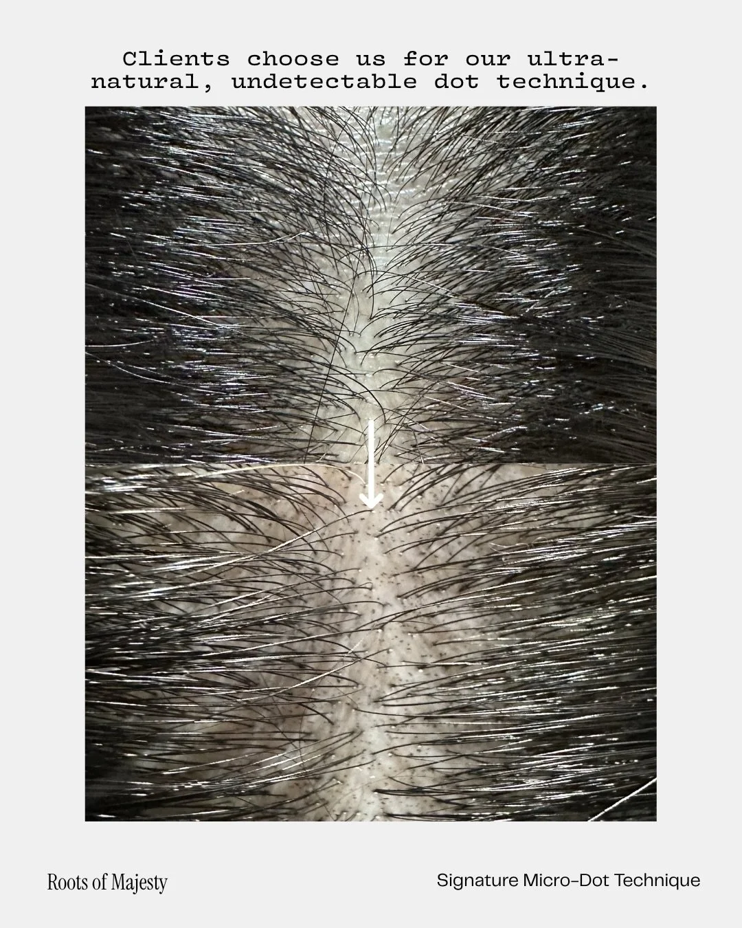 See the Roots of Majesty difference 👀