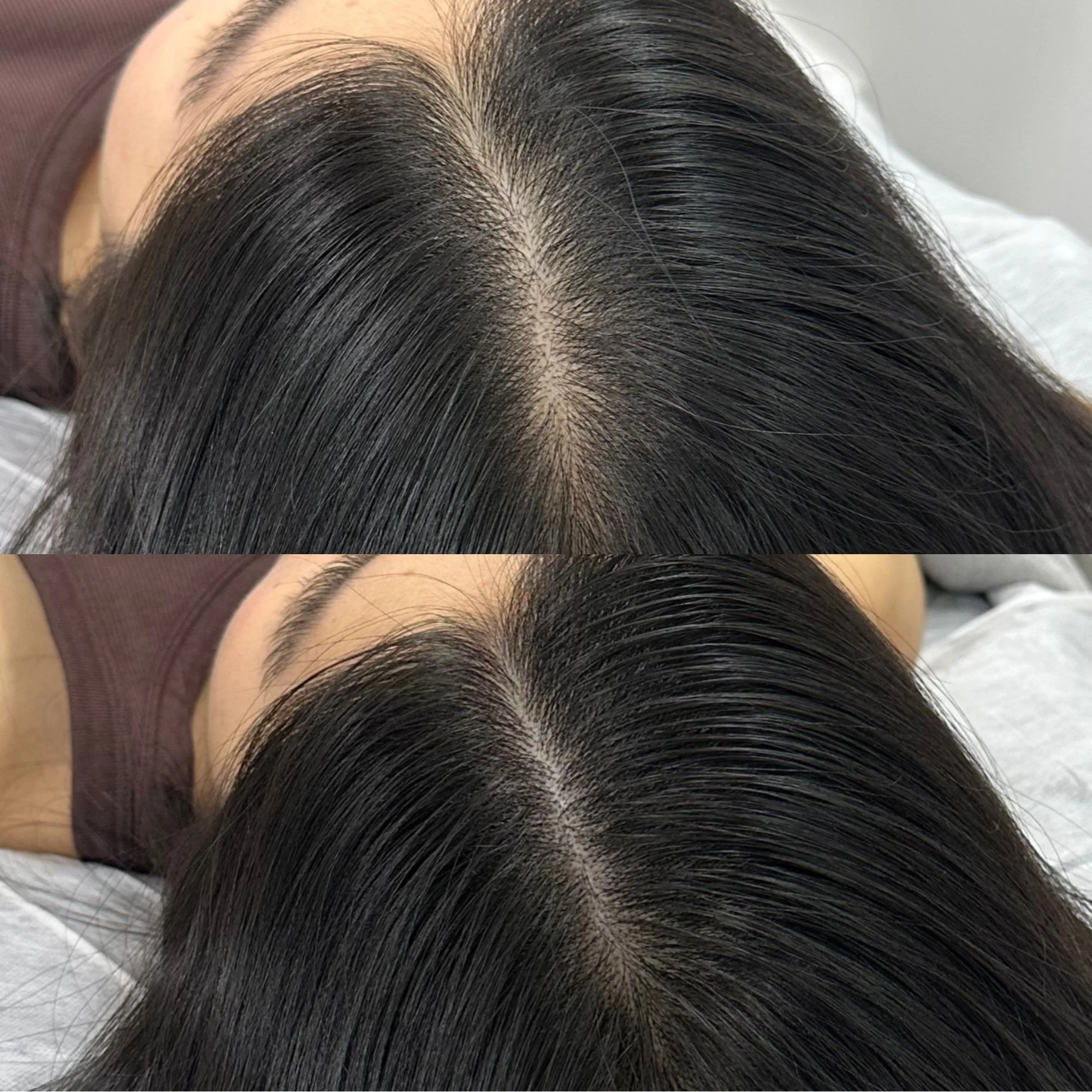 Close-up of a person's scalp showing dark, straight hair parted in the middle.
