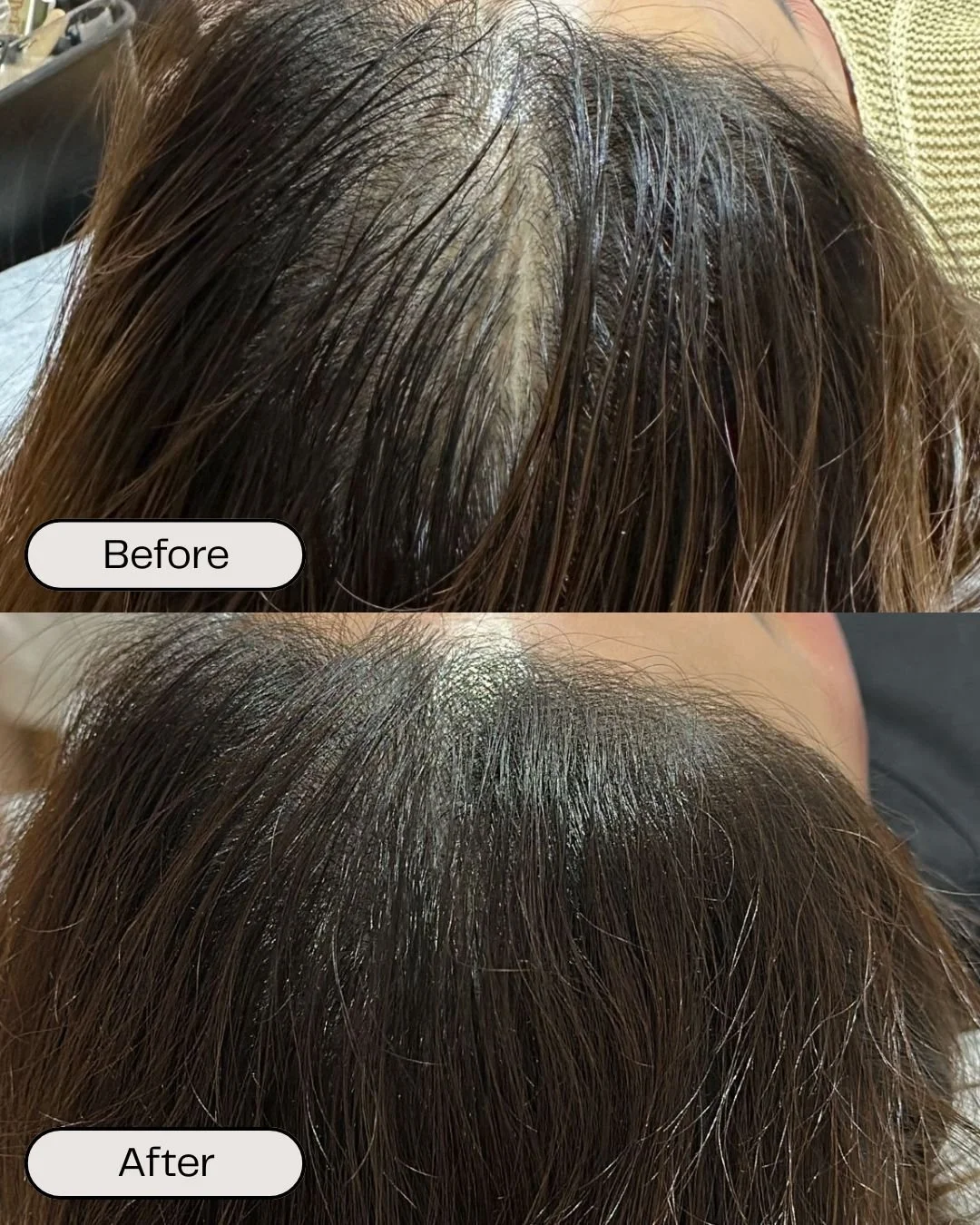 Comparison of a person's scalp before and after hair treatment. The 'before' image shows a scalp with greasy hair and visible dryness. The 'after' image shows a cleaner, shinier scalp with healthier hair.
