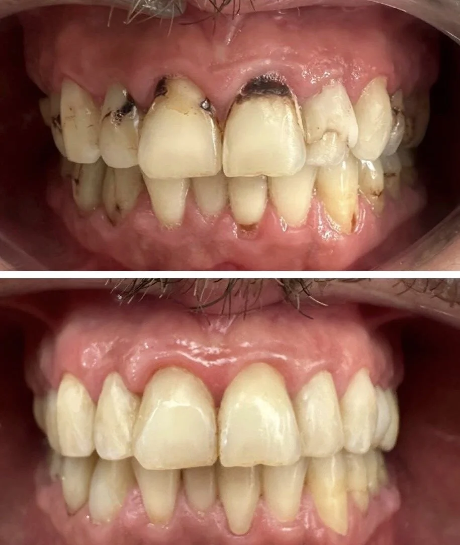 Rehabilitación Estética Integral