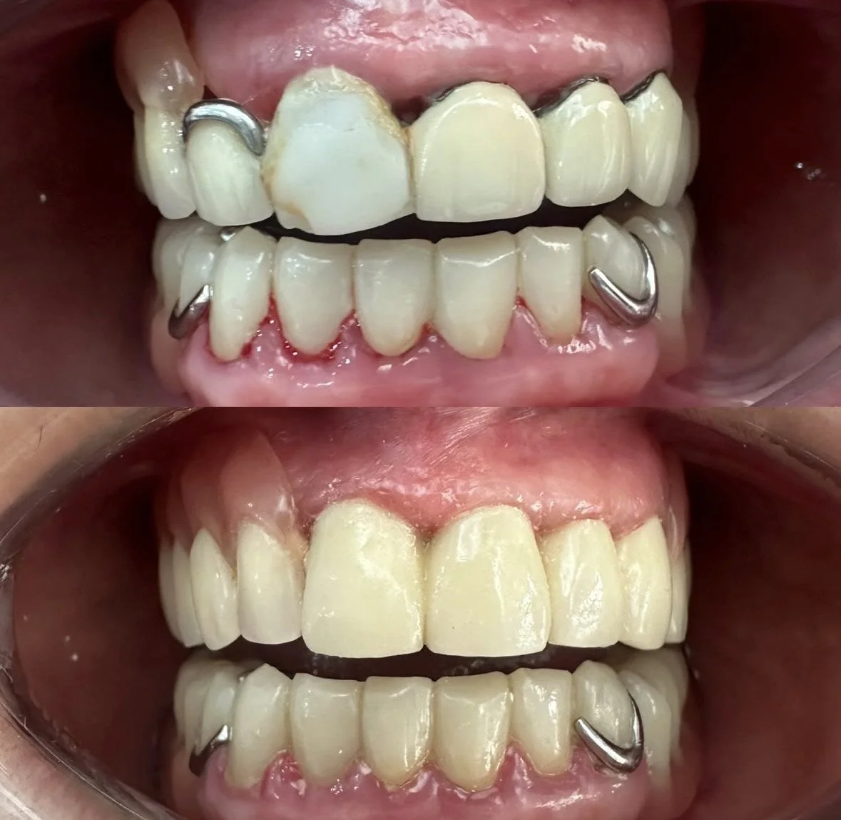 Rehabilitación Oral y Estética