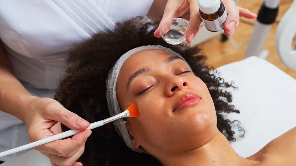 Chemical peel