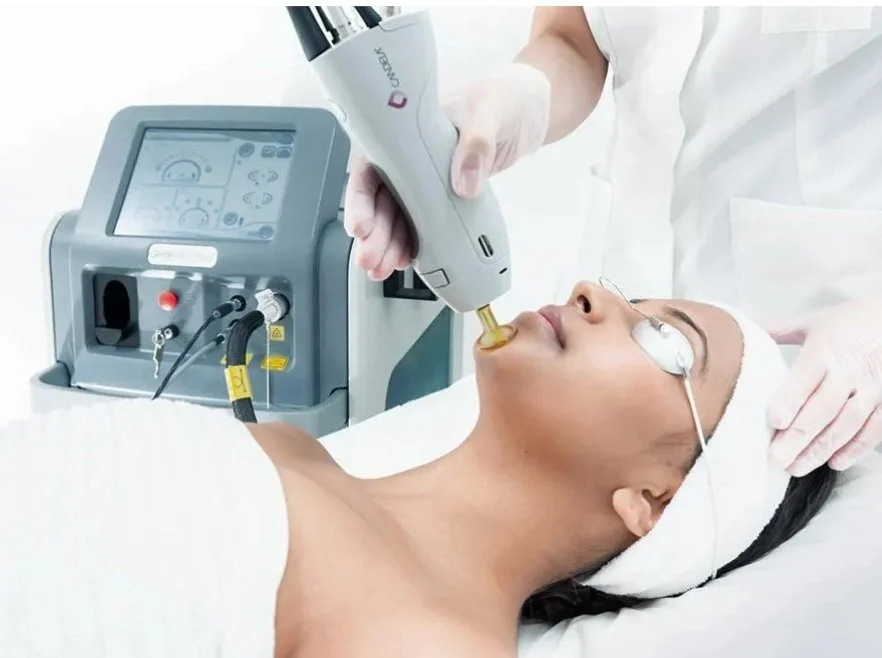 The Candela laser used at Precise