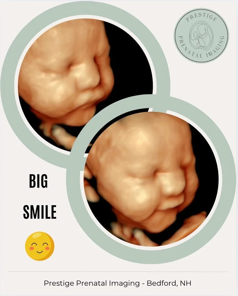 💛 Baby smiles make everything brighter! 😊
We were lucky enough to capture this little one smiling in 3D &mdash; and it completely melted our hearts! 🥰 
Seeing those sweet expressions in real time is what makes these moments so magical. 
How adorab