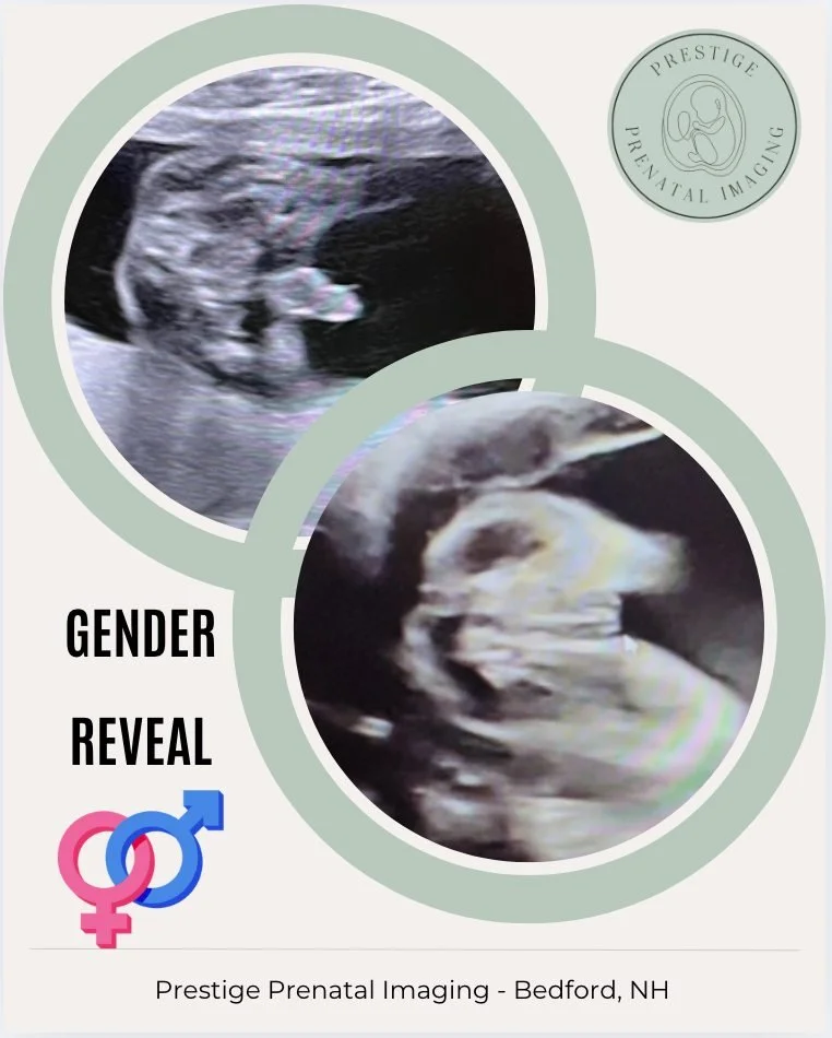 💙💗 Boy or Girl?! The excitement never gets old! 

We absolutely love being part of these special moments &mdash; there&rsquo;s nothing quite like being the first to share the big news with expecting parents! 

Whether it&rsquo;s pink or blue, every