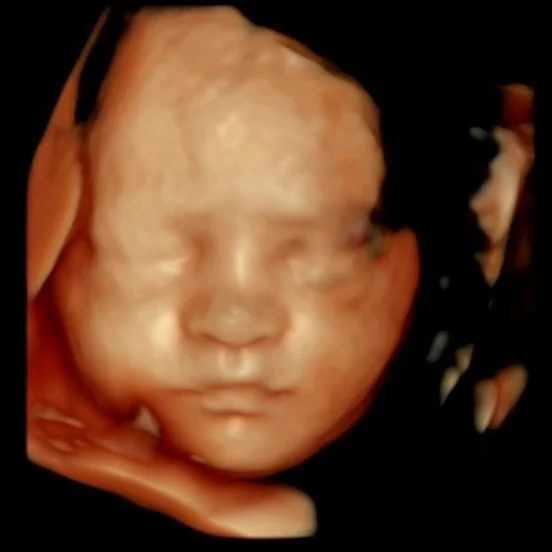 We got some absolutely adorable 3D/4D images of the precious baby &mdash; those little cheeks just melt our hearts 💕

If you&rsquo;re expecting and want to see your baby in incredible detail, come visit us at Prestige Prenatal Imaging in Bedford, NH