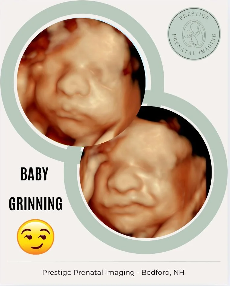 This little grin says it all 💛

It&rsquo;s truly amazing what we can see with 4D imaging &mdash; not only those sweet baby facial features, but even their tiny expressions! 

This moment melted everyone&rsquo;s hearts in the room &mdash; pure joy ca