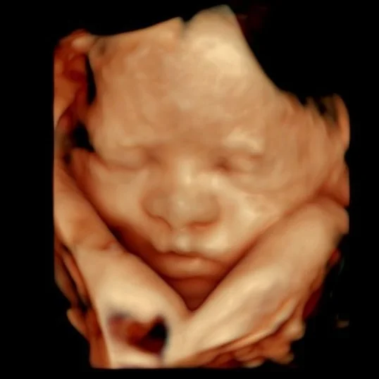 💖 We just can&rsquo;t get over how adorable this little one is! We captured some amazing 3D/4D images during their session &mdash; those tiny features are pure perfection 😍

At Prestige Prenatal Imaging in Bedford, NH, our registered sonographers t