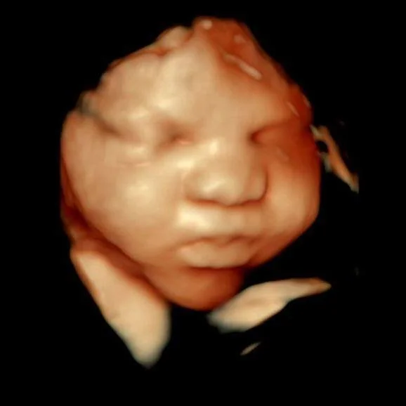 ✨ Pure joy captured on 3D/4D! ✨
Just look at this happy little one &mdash; we couldn&rsquo;t help but smile right along with them! 

Moments like these are what make what we do so special. Seeing your baby&rsquo;s expressions, little features, and bi