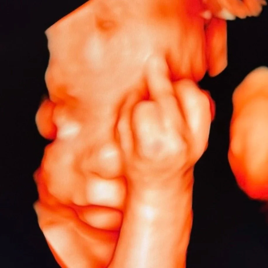 When baby already has attitude 😲
We&rsquo;ve seen sweet smiles&hellip; tiny yawns&hellip; even little waves&hellip;
But THIS little one?
Came in HOT and decided to flip off the camera! 🤣

Looks like Mom and Dad might have their hands full &mdash; t