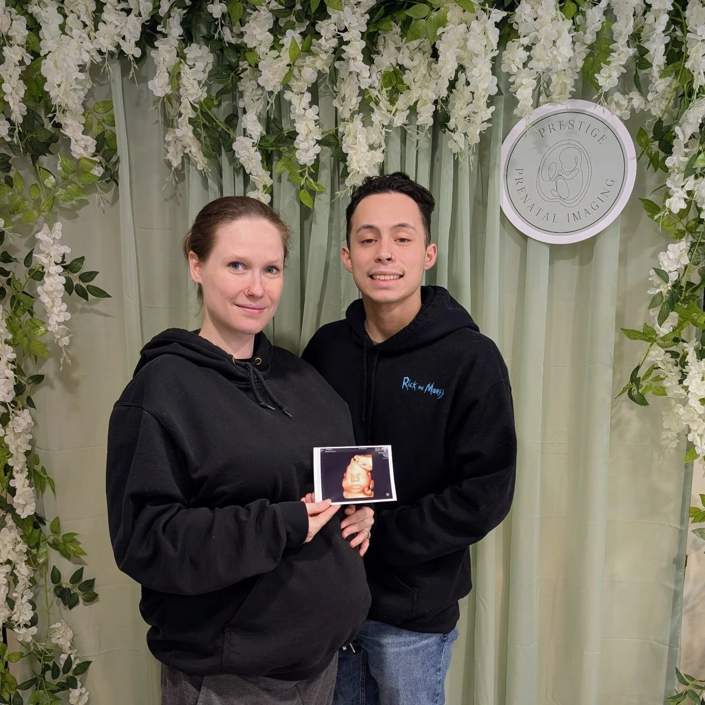 ✨ What a beautiful session with this wonderful couple! ✨

We captured some truly amazing 3D/4D images of their sweet baby, and it was such a joy to witness their excitement and love. 💛 These are the moments we live for &mdash; getting to share in th